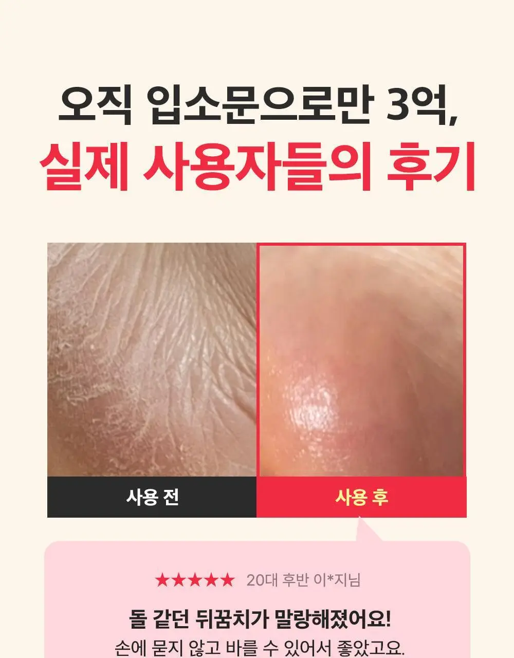 [데일리풋케어/맨들맨들아기발] 성분에디터 시어버터 베이비 풋 스틱 20g 2종 택 1 상세페이지 6